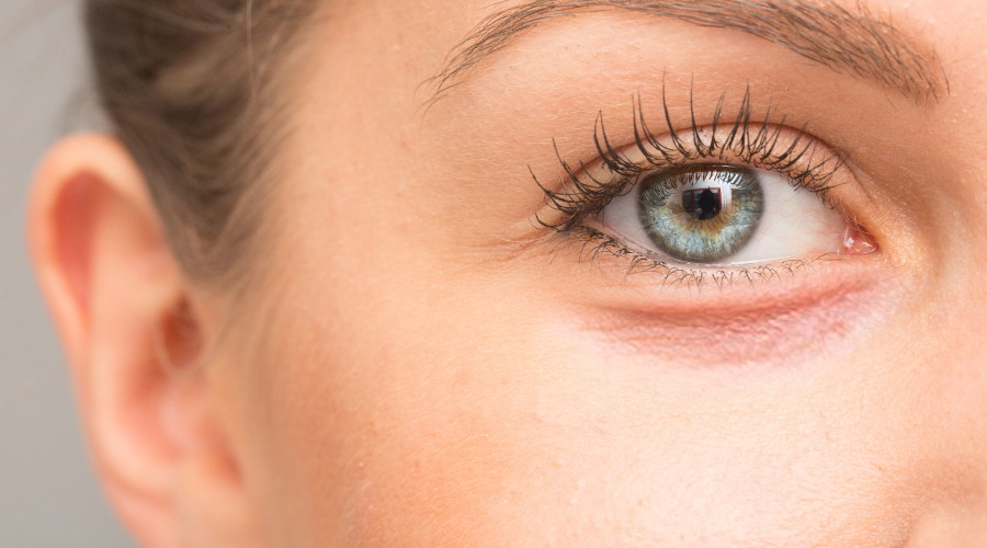 Dark Circles Under the Eyes: Causes and Treatments